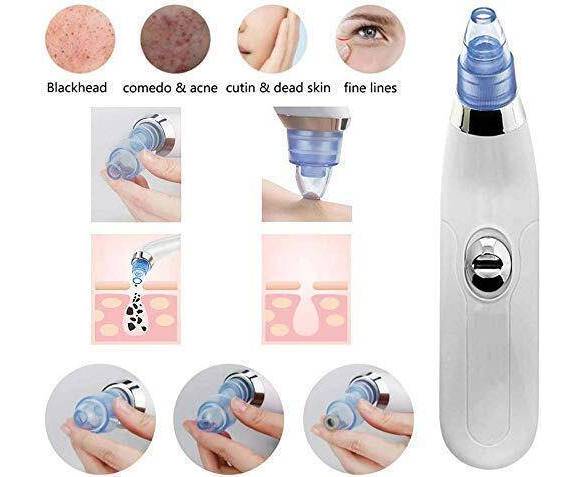 VIRTUALBAZAAR-Derma Suction Blackheads Remover 3 In 1 Black Head Remover Machine-acne Pimple Pore Cleaner Vacuum Suction Tool