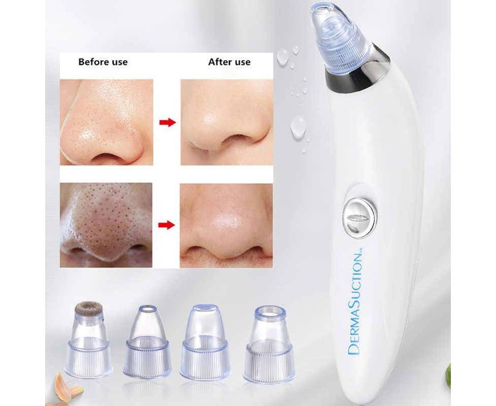 VIRTUALBAZAAR-Derma Suction Blackheads Remover 3 In 1 Black Head Remover Machine-acne Pimple Pore Cleaner Vacuum Suction Tool